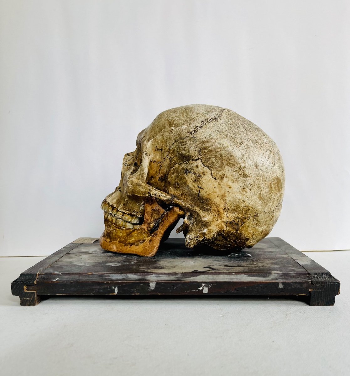 Human Skull -photo-3